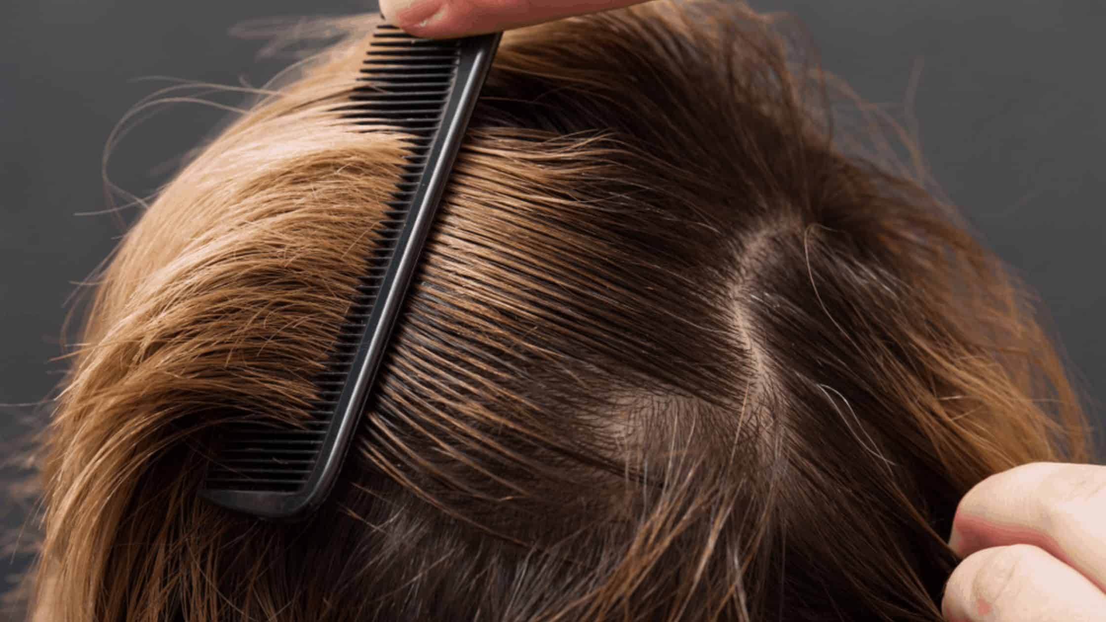 Kam wordt door bruin haar gehaald, close-up van de hoofdhuid